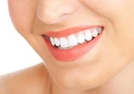 Smile Makeover