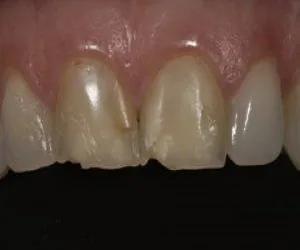 18-300x200-1