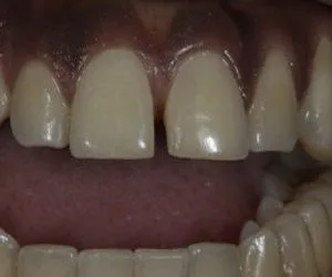 42-300x200-1