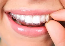 Invisalign
